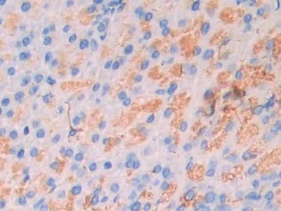 CA7 Antibody in Immunohistochemistry (Paraffin) (IHC (P))
