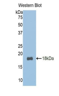 TCF20 Antibody in Western Blot (WB)