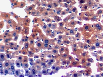Laminin gamma-3 Antibody in Immunohistochemistry (Paraffin) (IHC (P))
