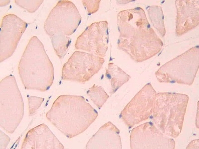 Carbonic Anhydrase XII Antibody in Immunohistochemistry (Paraffin) (IHC (P))