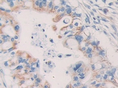 KIR2DL2 Antibody in Immunohistochemistry (Paraffin) (IHC (P))