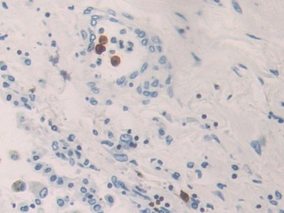 KIR2DL3 Antibody in Immunohistochemistry (Paraffin) (IHC (P))