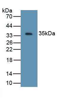 beta-2 Defensin Antibody in Western Blot (WB)