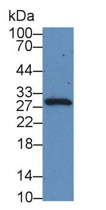Cryptic Antibody in Western Blot (WB)