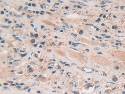 PION Antibody in Immunohistochemistry (Paraffin) (IHC (P))