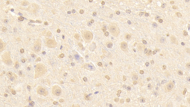 NUP133 Antibody in Immunohistochemistry (Paraffin) (IHC (P))
