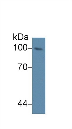 NUP98 Antibody in Western Blot (WB)