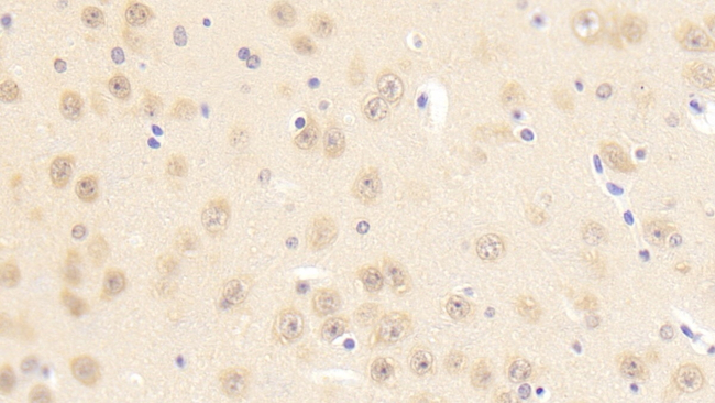 PCDHB2 Antibody in Immunohistochemistry (Paraffin) (IHC (P))