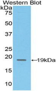 CD97 Antibody in Western Blot (WB)