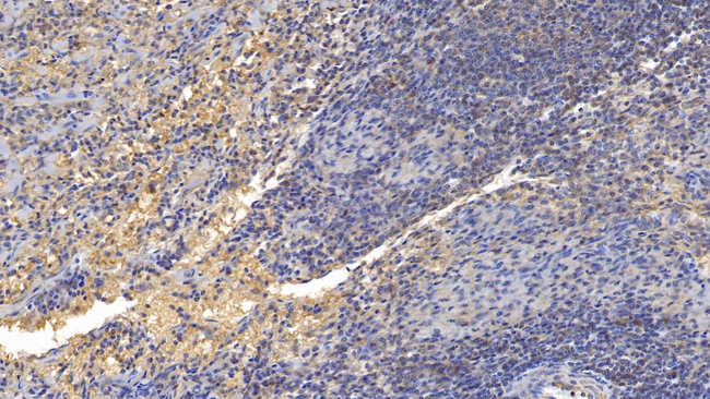 GITR (TNFRSF18) Antibody in Immunohistochemistry (Paraffin) (IHC (P))