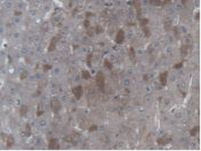 UBE2L3 Antibody in Immunohistochemistry (Paraffin) (IHC (P))