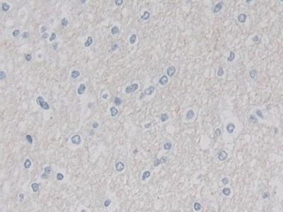 Cullin 9 Antibody in Immunohistochemistry (Paraffin) (IHC (P))