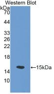 SLC30A5 Antibody in Western Blot (WB)