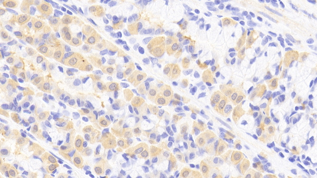 RARRES1 Antibody in Immunohistochemistry (Paraffin) (IHC (P))