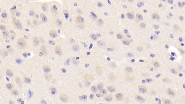 NEIL3 Antibody in Immunohistochemistry (Paraffin) (IHC (P))