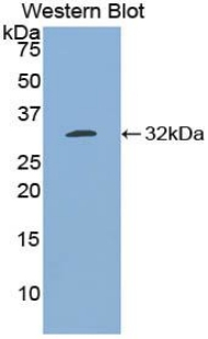 Bcl-3 Antibody in Western Blot (WB)