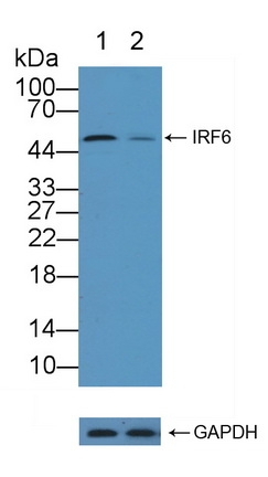 IRF6 Antibody in Western Blot (WB)