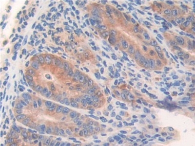 WARS Antibody in Immunohistochemistry (Paraffin) (IHC (P))