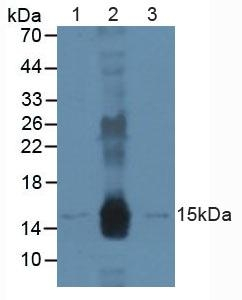 DDB2 Antibody in Western Blot (WB)