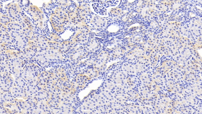 SERPINB3 Antibody in Immunohistochemistry (Paraffin) (IHC (P))