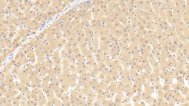 THRB Antibody in Immunohistochemistry (Paraffin) (IHC (P))