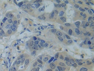 SNRPC Antibody in Immunohistochemistry (Paraffin) (IHC (P))