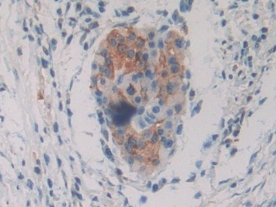 PKIG Antibody in Immunohistochemistry (Paraffin) (IHC (P))