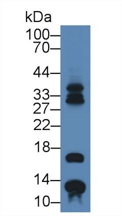 S100A7 Antibody in Western Blot (WB)