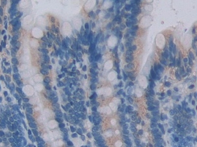 Centaurin alpha-2 Antibody in Immunohistochemistry (Paraffin) (IHC (P))
