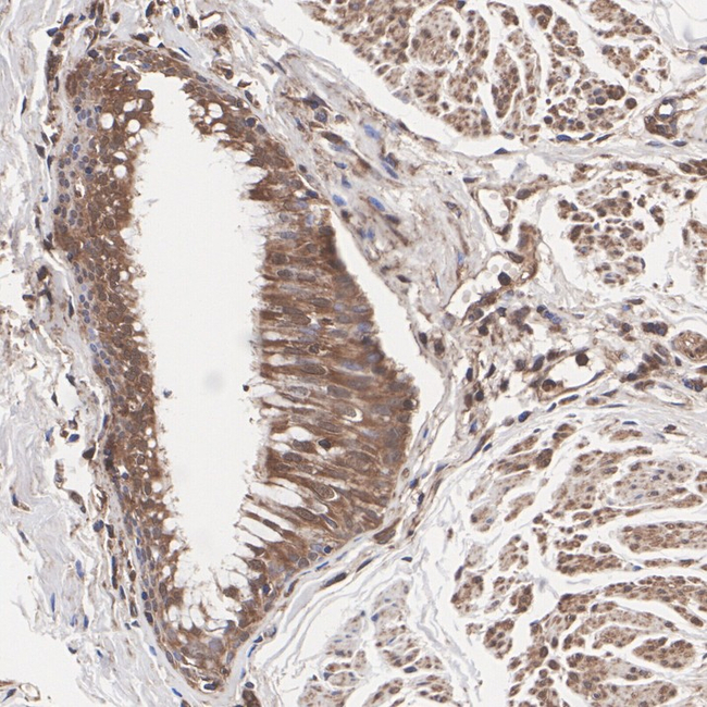 ALX1 Antibody in Immunohistochemistry (Paraffin) (IHC (P))