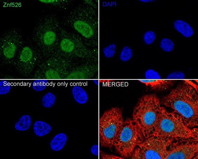 ZNF526 Antibody in Immunocytochemistry (ICC/IF)