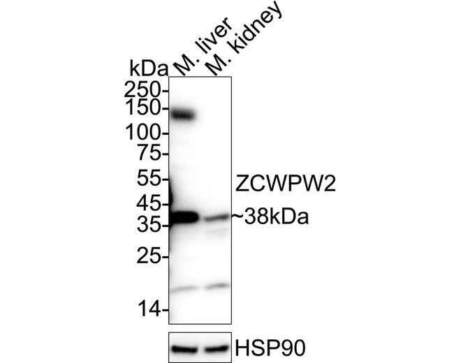ZCWPW2 Antibody in Western Blot (WB)