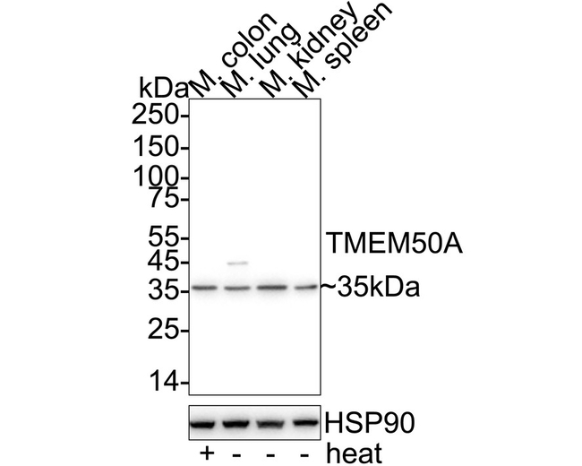 TMEM50A Antibody in Western Blot (WB)