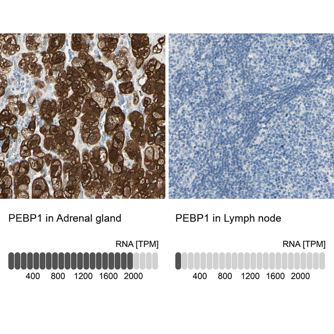 PEBP1 Antibody in Immunohistochemistry (Paraffin) (IHC (P))