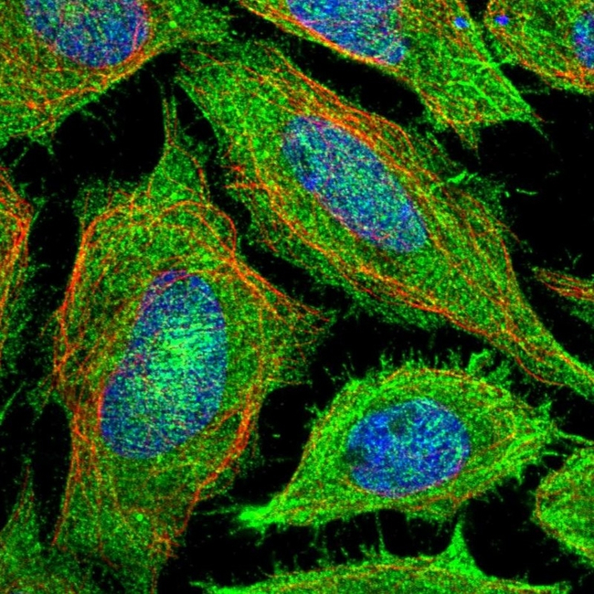 PAR4 Antibody in Immunocytochemistry (ICC/IF)