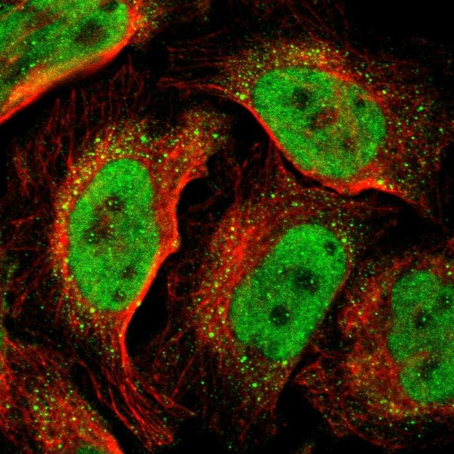 DNMT3B Antibody in Immunocytochemistry (ICC/IF)