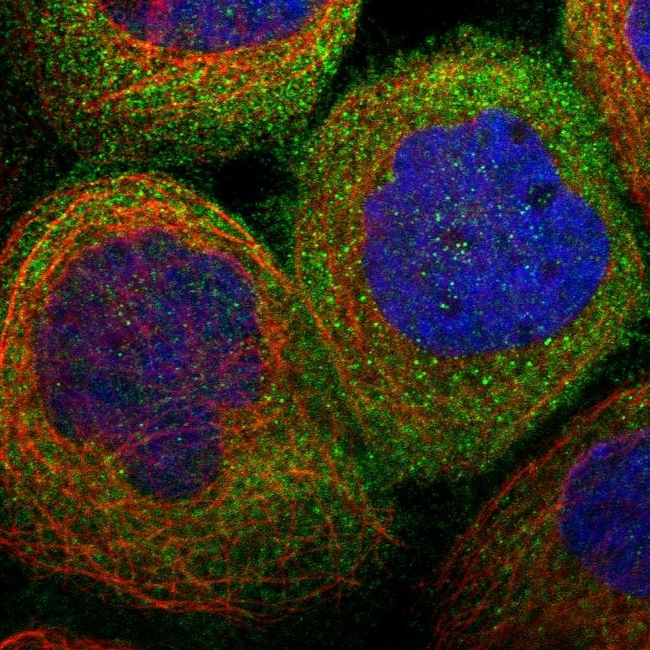 RIP1 Antibody in Immunocytochemistry (ICC/IF)