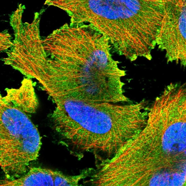 IKZF3 Antibody in Immunocytochemistry (ICC/IF)