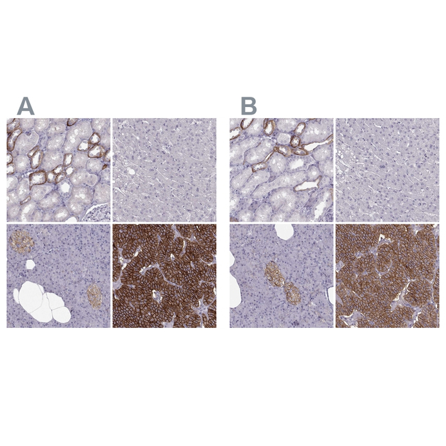 Calcium Sensing Receptor Antibody in Immunohistochemistry (Paraffin) (IHC (P))