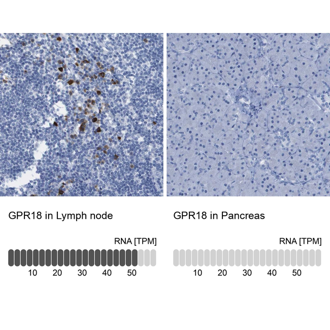 GPR18 Antibody in Immunohistochemistry (Paraffin) (IHC (P))