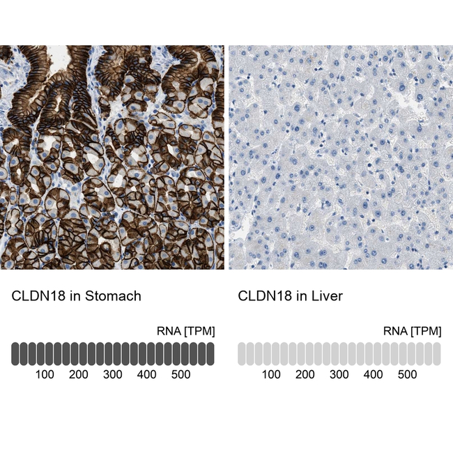 Claudin 18 Antibody in Immunohistochemistry (Paraffin) (IHC (P))