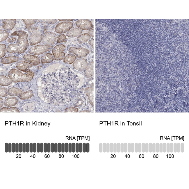 PTH1R Antibody in Immunohistochemistry (Paraffin) (IHC (P))