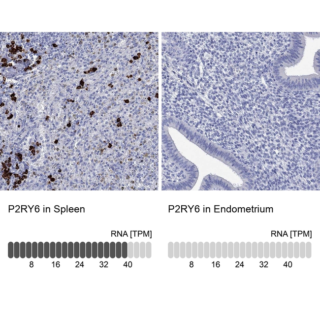 P2Y6 Antibody in Immunohistochemistry (Paraffin) (IHC (P))