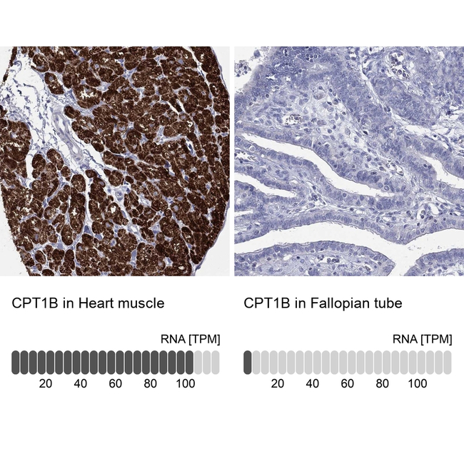 CPT1B Antibody in Immunohistochemistry (Paraffin) (IHC (P))