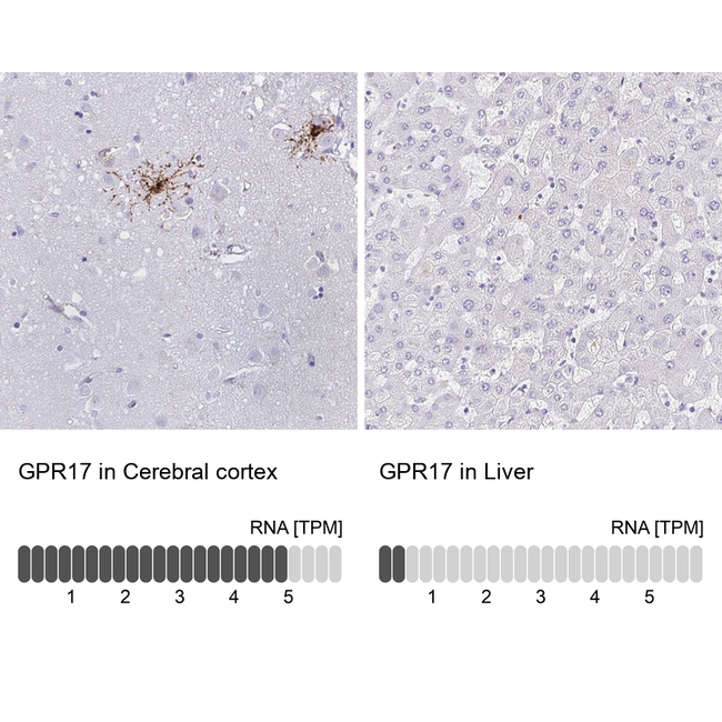 GPR17 Antibody in Immunohistochemistry (Paraffin) (IHC (P))