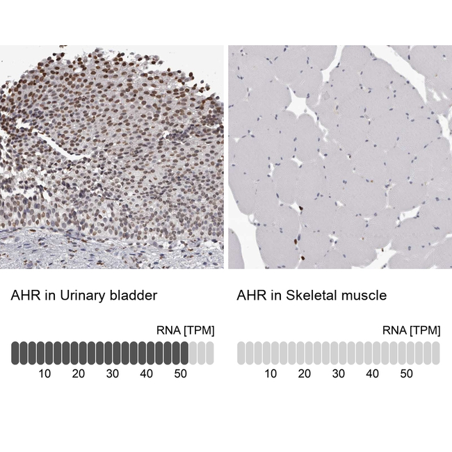 AHR Antibody in Immunohistochemistry (Paraffin) (IHC (P))