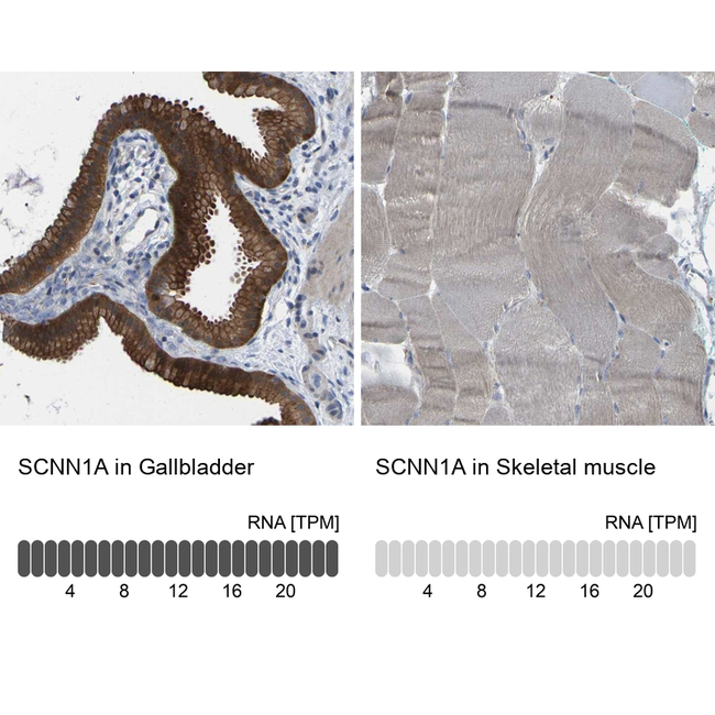 alpha-ENaC Antibody in Immunohistochemistry (Paraffin) (IHC (P))