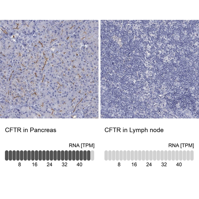 CFTR Antibody in Immunohistochemistry (Paraffin) (IHC (P))