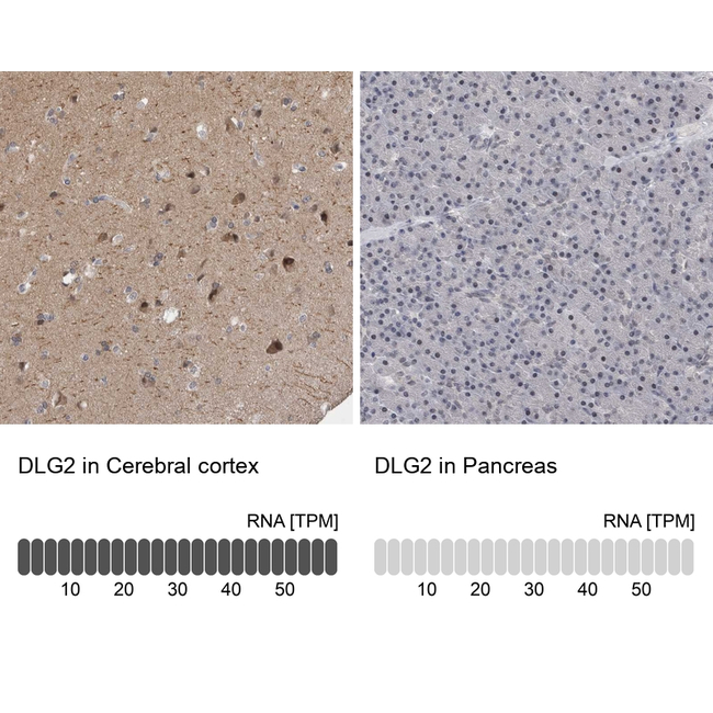 PSD93 Antibody in Immunohistochemistry (Paraffin) (IHC (P))