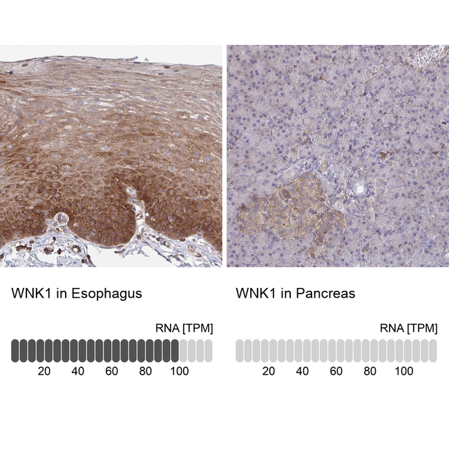 WNK1 Antibody in Immunohistochemistry (Paraffin) (IHC (P))